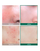 SOME BY MI AHA.BHA.PHA 30 Days Miracle Serum 50 ml