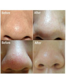 Ciracle Blackhead Off Sheet 35 sheets